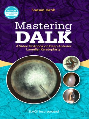 cover image of Mastering DALK